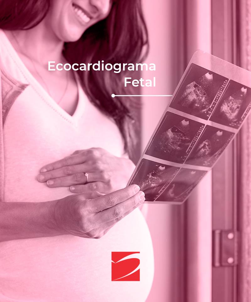 Ecocardiograma Fetal