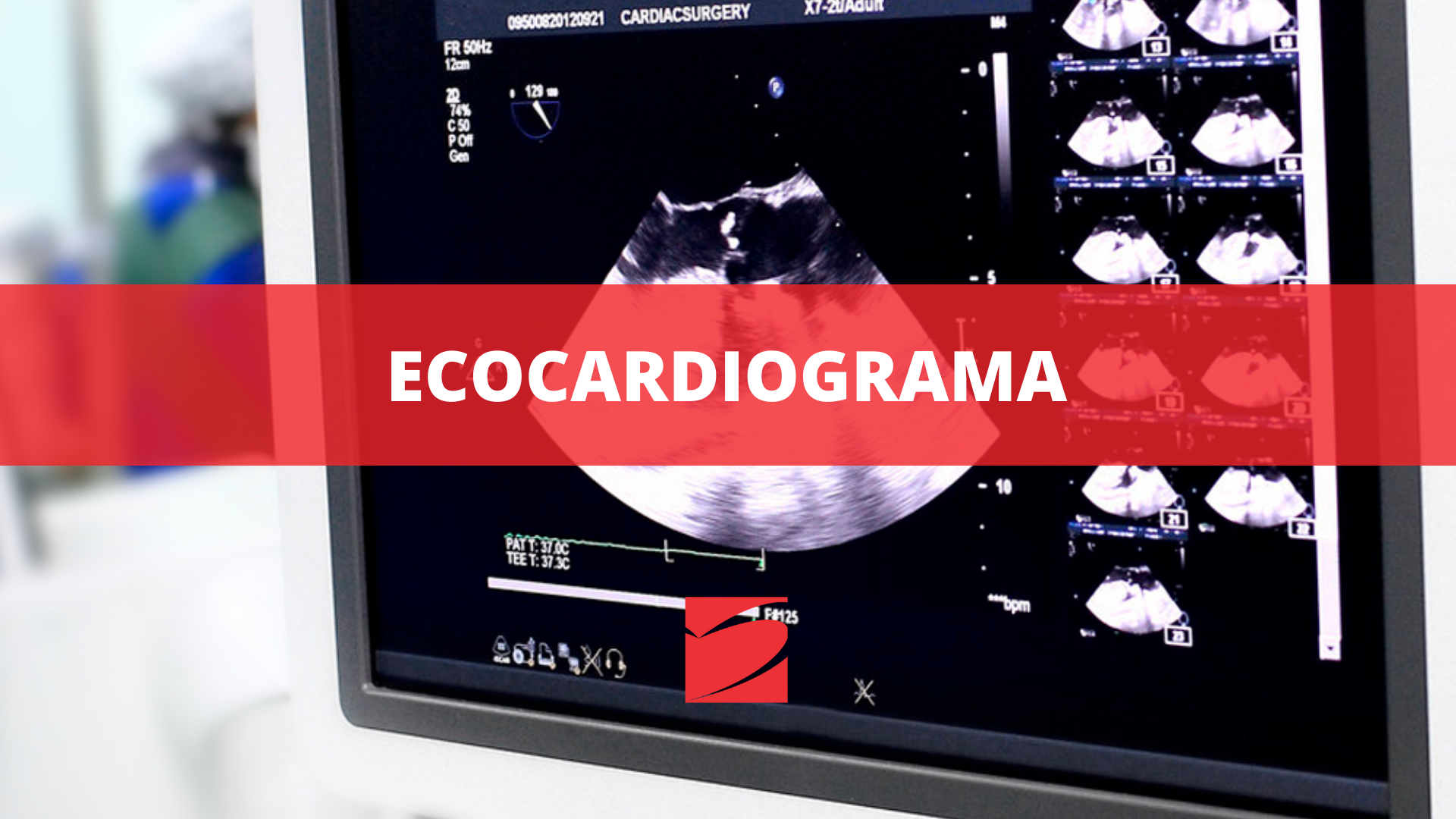 ECOCARDIOGRAMA