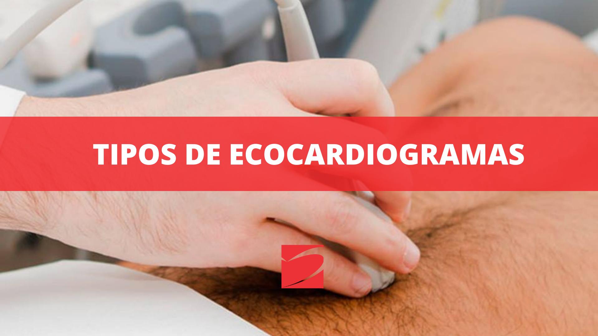 TIPOS DE ECOCARDIOGRAMAS