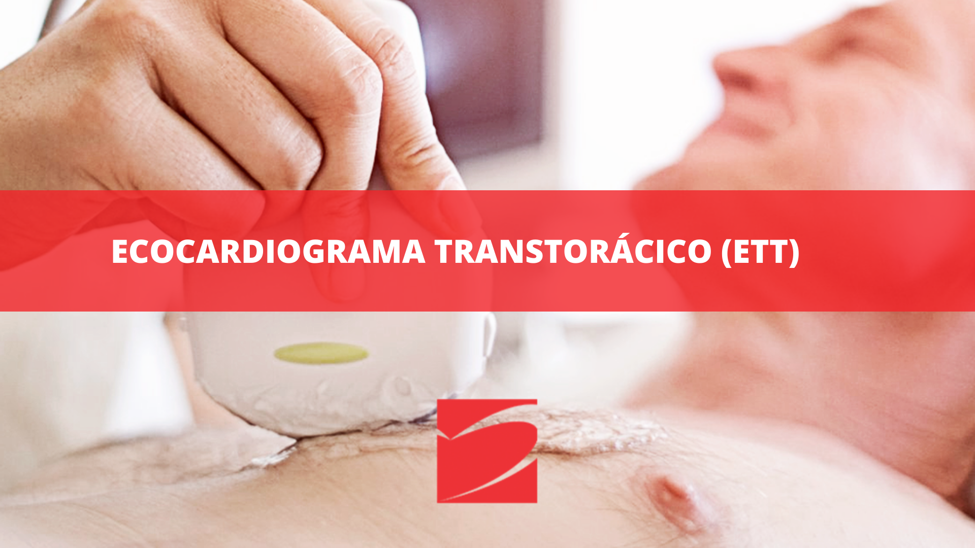 ECOCARDIOGRAMA TRANSTORÁCICO (ETT)