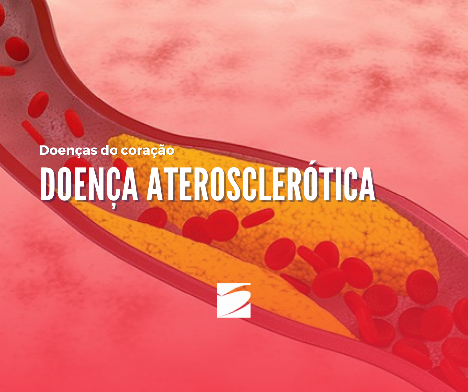 Entenda a Aterosclerose