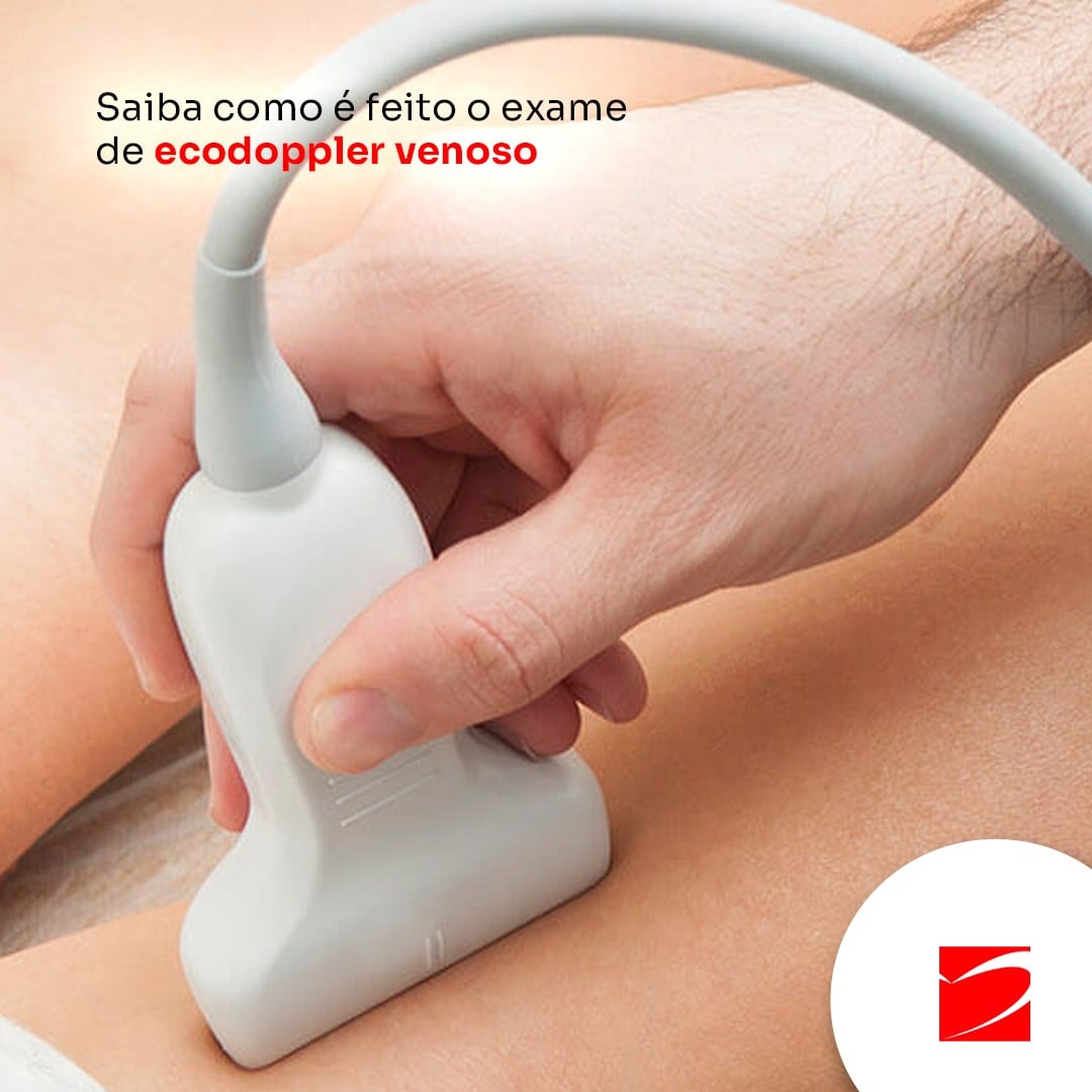 EXAME ECODOPPLER VENOSO