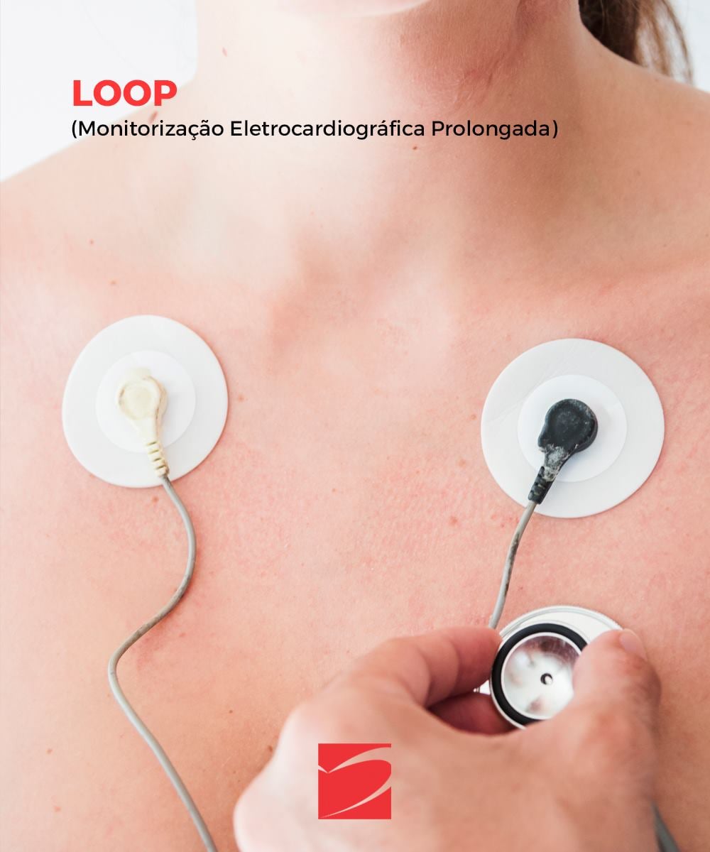 MetroCor - Instituto Metropolitano do Coração - 🔎O tilt-test é um exame  que analisa como o seu corpo regula a pressão arterial em diferentes  posições, ou seja, como ela se adapta ao