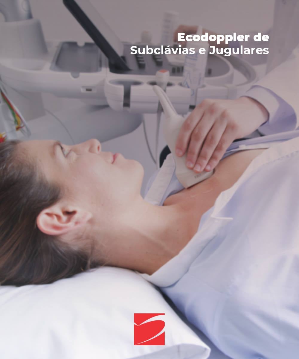 ECODOPPLER DE SUBCLÁVIAS E JUGULARES