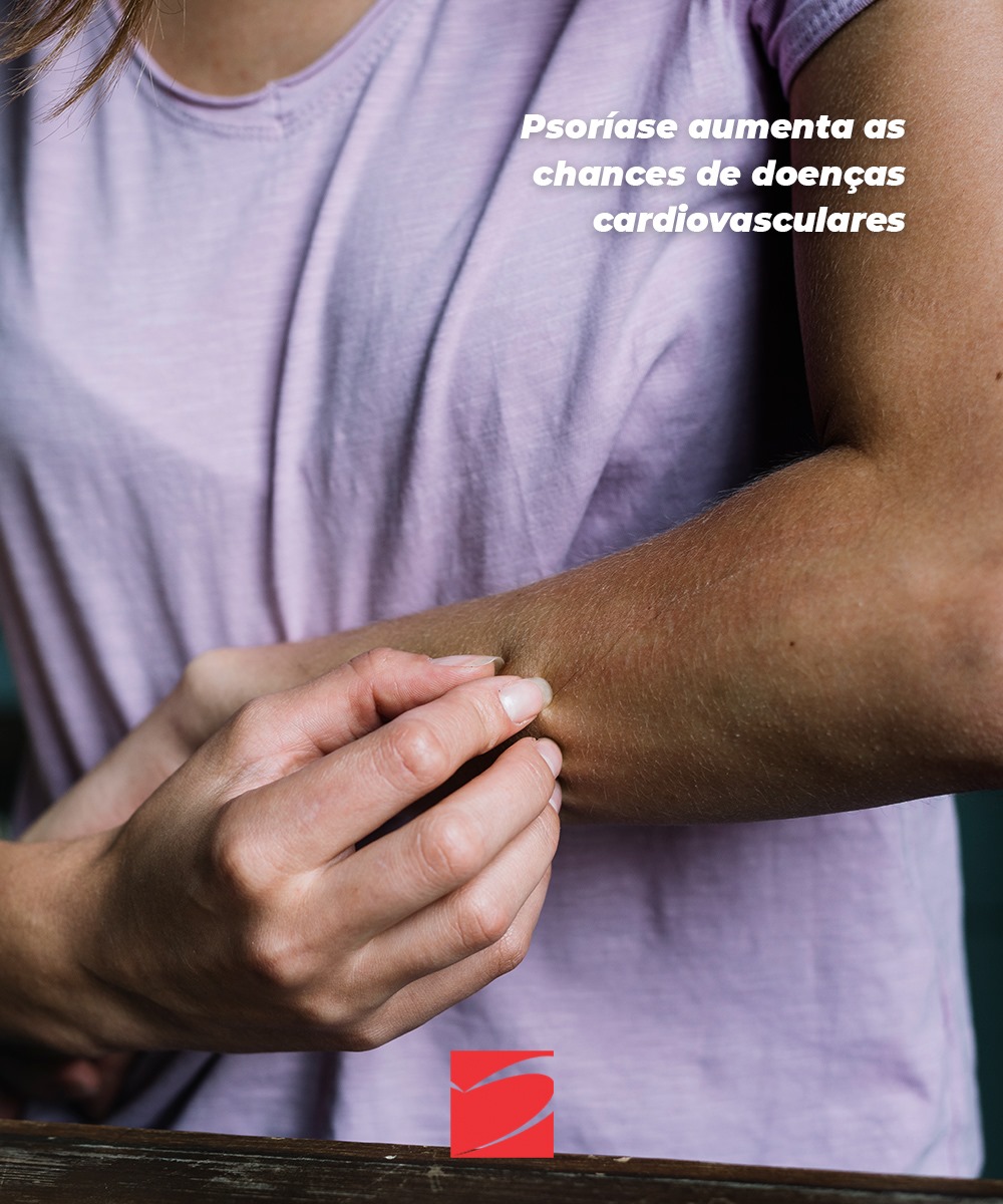 Psoríase aumenta as chances de doenças cardiovasculares