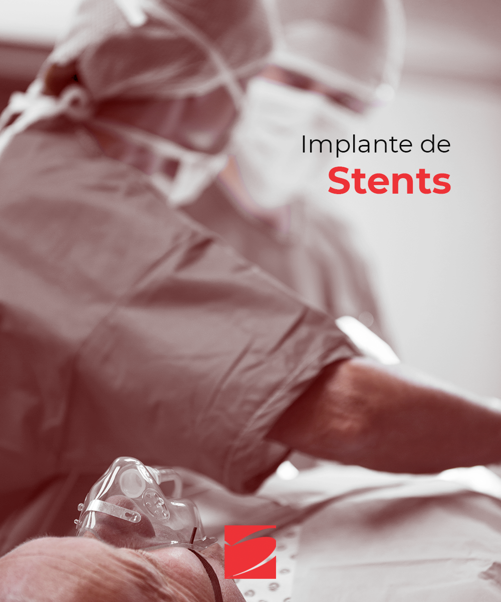 Implante de Stents