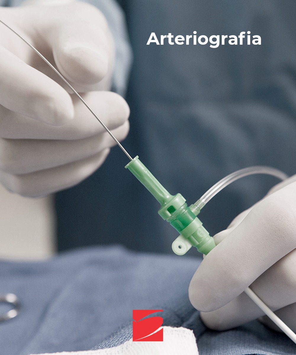 Arteriografia