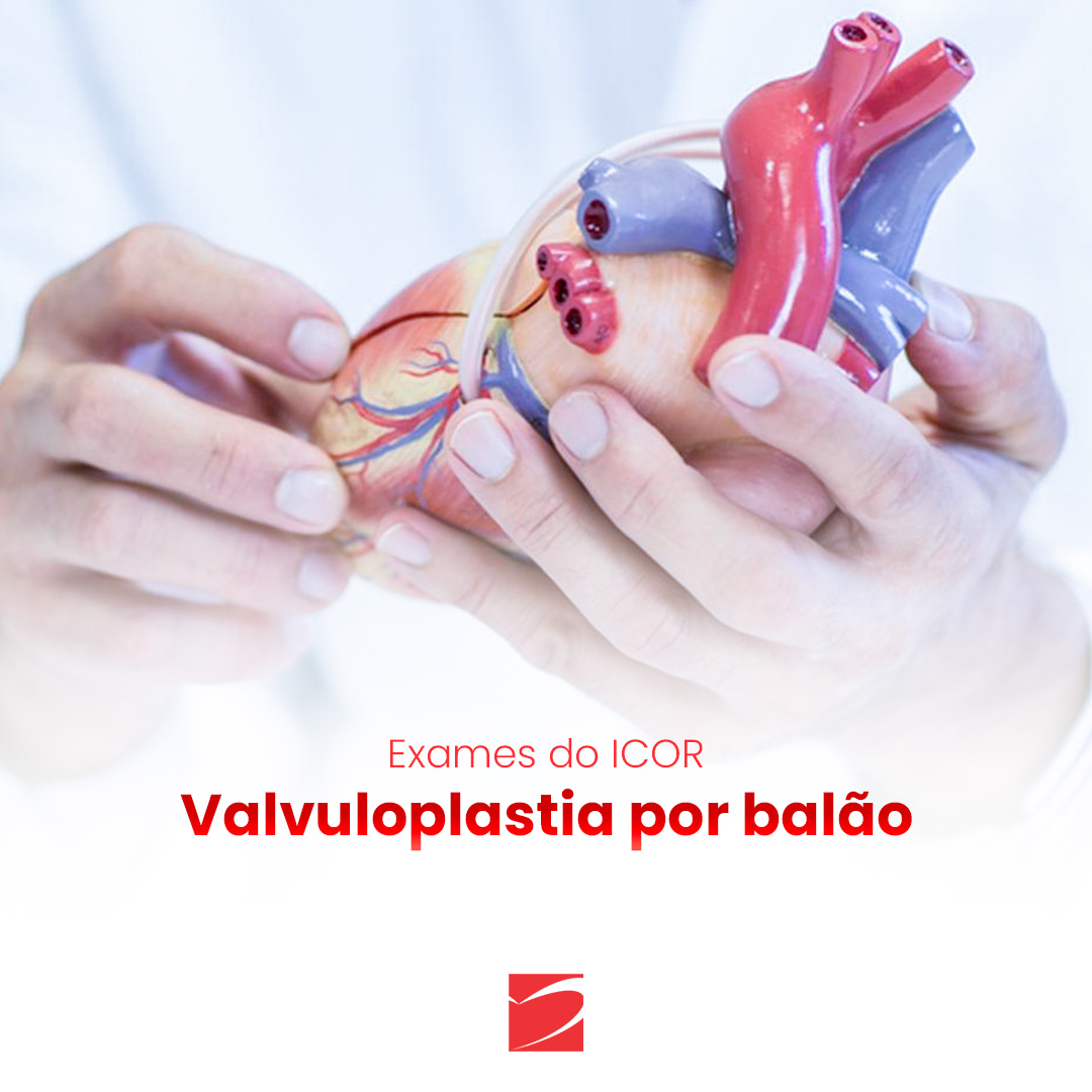 Valvuloplastia por balão