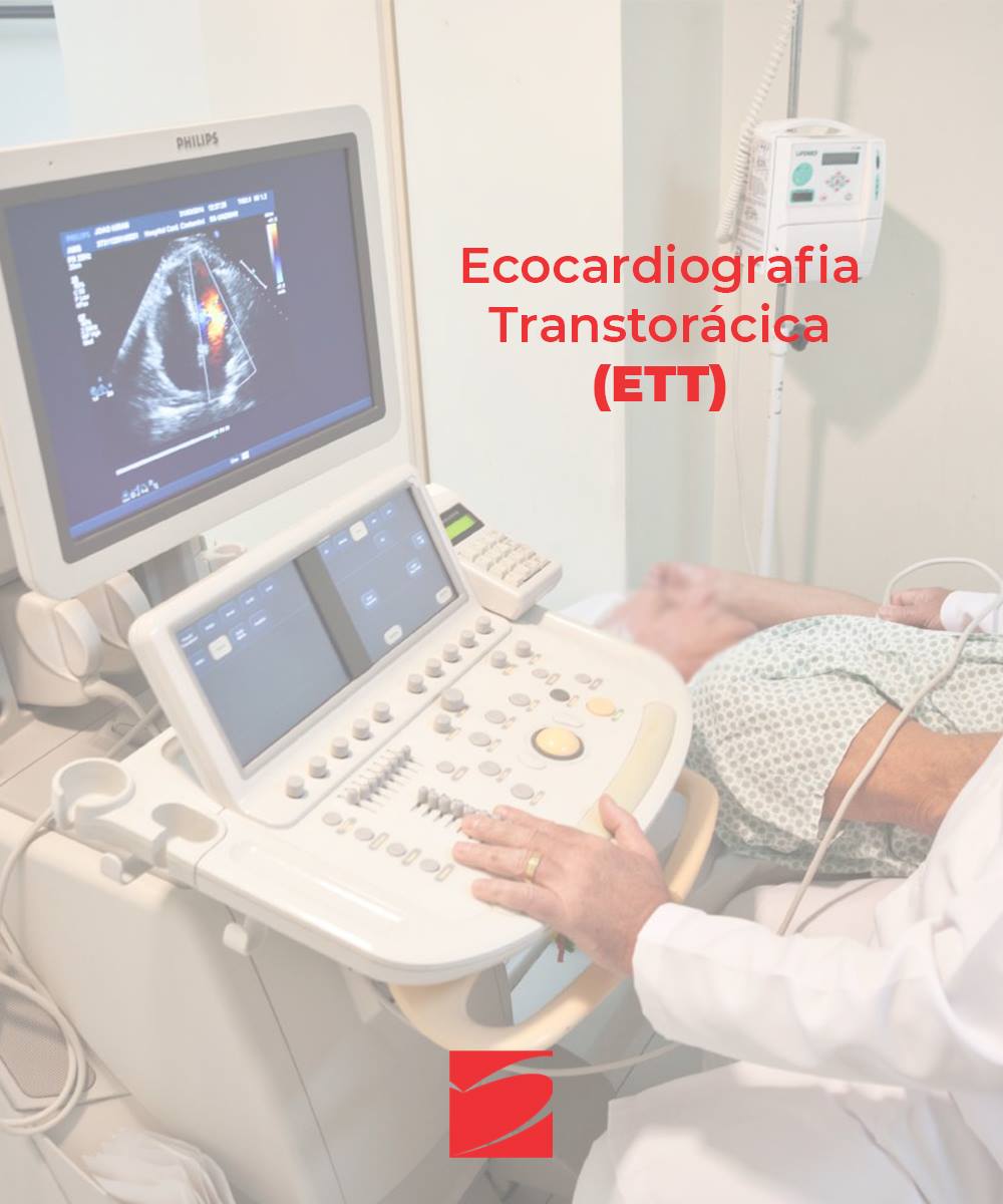 Ecocardiografia transtorácica